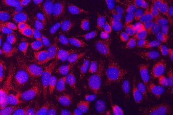 Immunofluorescent staining of FFPE human HeLa cells with MUNC18-1 antibody (red) and DAPI nuclear stain (blue). HIER: steam section in pH6 citrate buffer for 20 min.