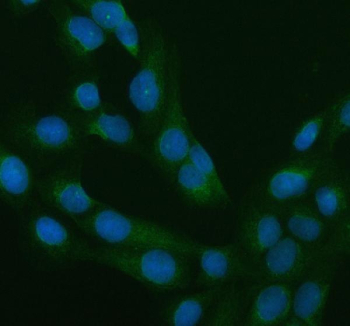 IF/ICC staining of FFPE human U-2 OS cells with RAB11 antibody (green) at 5ug/ml and DAPI nuclear stain (blue). HIER: steam section in pH6 citrate buffer for 20 min.