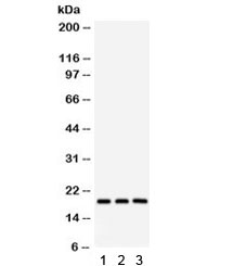 Western blot testing of 1) rat brain, 2) mouse brain and 3) human HeLa lysate with SFRS3 antibody. Predicted/observed molecular weight ~19 kDa.