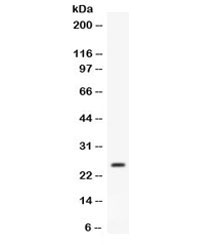 Western blot testing of mouse liver lysate with Apolipoprotein A I antibody. Predicted molecular weight ~30 kDa.