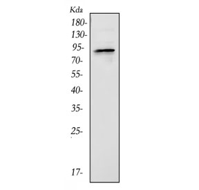 Western blot testing of mouse liver tissue lysate with BCHE antibody. Expected molecular weight: 66-110 kDa depending on glycosylation level.
