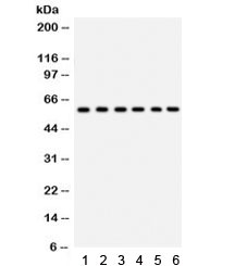 Western blot testing of 1) rat thymus, 2) rat lung, 3) HeLa, 4) 22RV1, 5) A431 and 6) mouse HEPA lysate with CYP24A1 antibody. Predicted/observed molecular weight ~59 kDa.