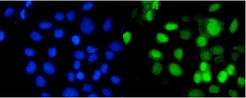 Immunofluorescent staining of FFPE human A431 cells with RBBP4 antibody (green) and DAPI nuclear stain (blue). HIER: steam section in pH6 citrate buffer for 20 min.