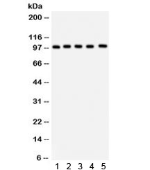 Western blot testing of 1) rat brain, 2) rat liver, 3) human HeLa, 4) HepG2 and 5) mouse HEPA lysate with ASPH antibody. Predicted molecular weight ~86 kDa, observed here at ~100 kDa.