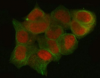 Immunofluorescent staining of FFPE human T-47D cells with CTBP1 antibody (red) and Alpha Tubulin mAb (green). HIER: steam section in pH6 citrate buffer for 20 min.