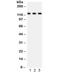 Western blot testing of 1) mouse heart, 2) human 22RV1 and 3) human HeLa cell lysate with PLD1 antibody. Expected/observed molecular weight: ~124 kDa.