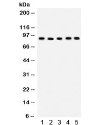 Western blot testing of 1) rat spleen, 2) rat lung, 3) rat thymus, 4) mouse lung, 5) human SW620 lysate with Cullin 1 antibody. Predicted/observed molecular weight ~90 kDa.