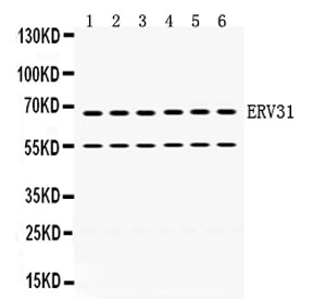 Western blot testing of human 1) HeLa, 2) 22RV1, 3) HepG2, 4) SKOV, 5) A431 and 6) HT1080 cell lysate with ERV3 antibody. Predicted molecular weight ~68 kDa.