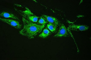 Immunofluorescent staining of human U-2 OS cells with Plectin antibody (green) and DAPI (blue). HIER: boil tissue sections in pH6, 10mM citrate buffer, for 20 min and allow to cool before testing.