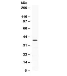 Western blot testing of human HeLa cell lysate with PON2 antibody. Expected/observed molecular weight ~39 kDa.