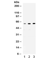 Western blot testing of 1) rat brain, 2) human placenta and 3) human PANC lysate with p54nrb antibody. Predicted molecular weight ~54 kDa.