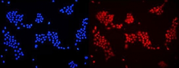 Immunofluorescent staining of FFPE human A431 cells with DDB1 antibody (red) and DAPI nuclear stain (blue). HIER: steam section in pH6 citrate buffer for 20 min.