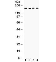Western blot testing of human 1) 293, 2) SW620, 3) COLO320 and 4) HeLa cell lysate with HKDC1 antibody. Expected molecular weight: ~103 kDa, observed here at ~170 kDa.