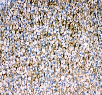 IHC staining of FFPE rat adrenal gland tissue with Srb1 antibody. HIER: boil tissue sections in pH8 EDTA for 20 min and allow to cool before testing.