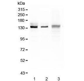 Western blot testing of 1) rat liver, 2) mouse liver and 3) mouse HEPA1-6 lysate with CP antibody. Expected molecular weight ~130 kDa.