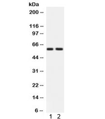 Western blot testing of 1) rat brain and 2) human HeLa lysate with ATG14L antibody. Expected/observed molecular weight ~59 kDa.