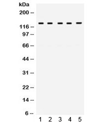 Western blot testing of human 1) HeLa, 2) 22RV1, 3) SW620, 4) A549 and 6) A431 cell lysate with TRPM8 antibody. Expected/observed molecular weight ~128 kDa.