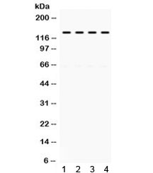 Western blot testing of mouse 1) brain, 2) spleen, 3) testis, and 4) liver lysate with TRIF antibody. Predicted molecular weight: 76 kDa but routinely observed at 70-150 kDa.