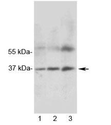 Western blot testing of 1) rat heart, 2) rat skeletal muscle and 3) human MCF7 lysate with MRGX1 antibody. Expected molecular weight ~37 kDa.