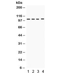 Western blot testing of 1) rat spleen, 2) rat thymus, 3) human placenta and 4) HeLa lysate with HDAC7 antibody. Expected/observed molecular weight ~103 kDa.