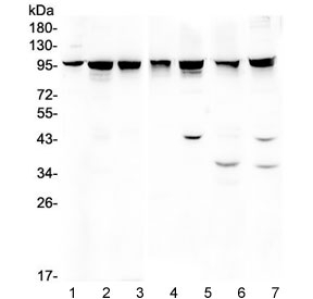 Western blot testing of 1) rat brain, 2) rat testis, 3) rat liver, 4) mouse liver, 5) mouse spleen, 6) mouse NIH3T3 and 7) human HeLa lysate wtih ALIX antibody. Expected/observed molecular weight ~96 kDa.
