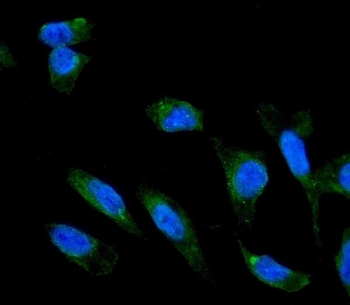 Immunofluorescent staining of FFPE human U-2 OS cells with ADIPOR1 antibody (green) and DAPI nuclear stain (blue). HIER: steam section in pH6 citrate buffer for 20 min.