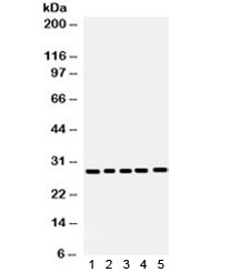 Western blot testing of 1) mouse lung, 2) mouse liver, 3) human SW620, 4) SMMC and 5) human placenta lysate using APH1A antibody.  Expected/observed molecular weight: 27~29 kDa.