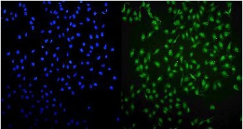 Immunofluorescent staining of FFPE human U-2 OS cells with UHRF1 antibody (green) and DAPI nuclear stain (blue). HIER: steam section in pH6 citrate buffer for 20 min.