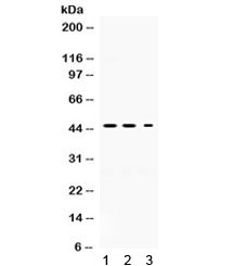Western blot testing of 1) rat brain, 2) mouse brain, and 3) PANC lysate with Neuroserpin antibody. Expected/observed molecular weight ~46 kDa.