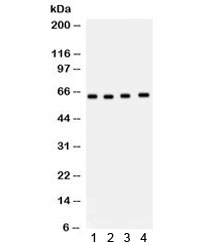 Western blot testing of 1) rat brain, 2) human Jurkat, 3) MM231 and 4) HT1080 lysate with CDC6 antibody. Predicted/observed molecular weight: ~62 kDa.