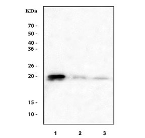 Western blot testing of 1) human A431, 2) rat PC-12 and 3) mouse brain tissue lysate with CIB1 antibody. Predicted molecular weight ~21 kDa.