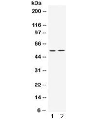 Western blot testing of 1) rat thymus and 2) human Jurkat lysate with VRK1 antibody. Predicted molecular weight ~45 kDa, observed here at ~55 kDa.