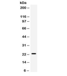 Western blot testing of mouse HEPA cell lysate with SECTM1 antibody. Expected/observed molecular weight ~23 kDa.