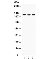 Western blot testing of 1) rat testis, 2) rat brain and 3) human HeLa lysate with CYLD antibody. Predicted/observed molecular weight ~107 kDa.