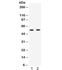 Western blot testing of human 1) HepG2 and 2) A549 cell lysate with GLUT9 antibody. Expected molecular weight: 59/56 kDa (L/S forms).
