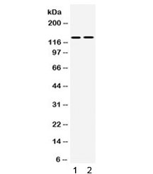 Western blot testing of human 1) SMMC and 2) 293 cell lysate with TRPM5 antibody. Expected/observed molecular weight ~131 kDa.