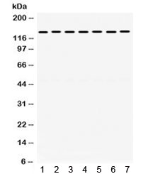 Western blot testing of 1) rat brain, 2) rat liver, 3) rat testis, 4) human HeLa, 5) human A549, 6) human MCF7 and 7) mouse NIH3T3 lysate with SMC3 antibody. Exepcted/observed molecular weight ~141 kDa.