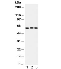 Western blot testing of 1) rat liver, 2) human placenta, 3) A549 lysate with Heparanase 1 antibody. Predicted molecular weight: 61 kDa (isoform 1), ~53 kDa (isoform 2/3), ~43 kDa (isoform 4).