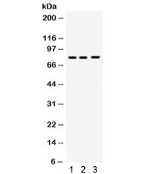 Western blot testing of 1) rat liver, 2) human HeLa and 3) human SW620 lysate with DNA polymerase eta antibody. Expected/observed molecular weight ~78 kDa.