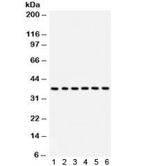 Western blot test of 1) rat brain, 2) human HepG2, 3) (h) SMMC, 4) (h) U87, 5) (h) placenta, 6) (h) HeLa lysate with STRAP antibody. Predicted/observed molecular weight ~38 kDa.