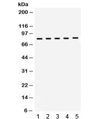 Western blot testing of 1) rat brain, 2) rat testis, 3) mouse brain, 4) mouse testis, 5) human MCF7 lysate with KIF3A antibody. Expected/observed molecular weight ~80 kDa.
