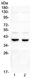 Western blot testing of 1) rat testis and 2) mouse testis lysate with DMRT1 antibody. Expected/observed molecular weight ~39 kDa.