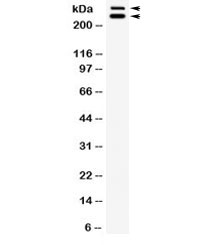 Western blot testing of rat testis lysate with WNK1 antibody. Expected molecular weight: 206-300 kDa (6 isoforms).
