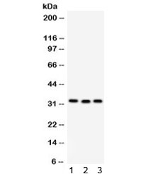 Western blot testing of 1) rat liver, 2) mouse spleen and 3) human MCF7 lysate with C1QBP antibody. Expected molecular weight ~31 kDa.
