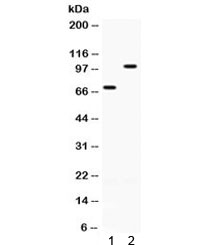 Western blot testing of 1) rat ovary and 2) human SKOV lysate with ZP1 antibody. Expected molecular weight: 70/90-110 kDa (unmodified/glycosylated).