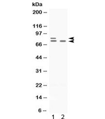 Western blot testing of 1) rat ovary and 2) human SKOV lysate with PLZF antibody. Predicted molecular weight: 74-81 kDa.