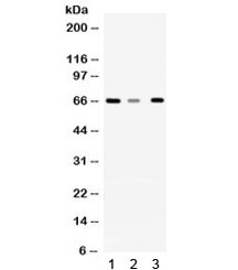 Western blot testing of 1) rat liver, 2) mouse brain and 3) A431 lysate with WDR1 antibody. Expected/observed molecular weight ~66 kDa.