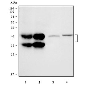Western blot testing of 1) human HCCT, 2) human HCCP, 3) rat liver and 4) mouse liver tissue lysate with ORM1 antibody. Expected molecular weight: 24/41-60 kDa (unmodified/glycosylated).