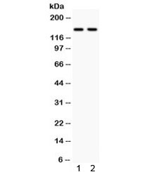 Western blot testing of human 1) HeLa and 2) 22RV1 cell lysate with Calcium Sensing Receptor antibody. Predicted molecular weight ~121 kDa, but is routinely observed at up to ~160 kDa.