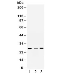 Western blot testing of 1) rat liver, 2) rat brain and 3) human SMMC-7721 lysate with Sorcin antibody. Predicted molecular weight ~22 kDa, routinely observed at 22-29 kDa.